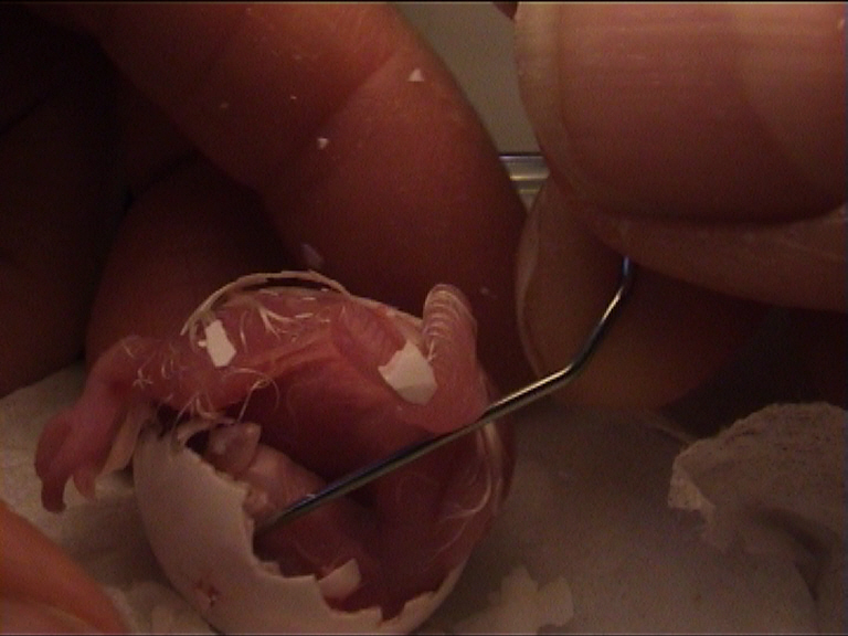 cÃ©sarienne 10.jpg