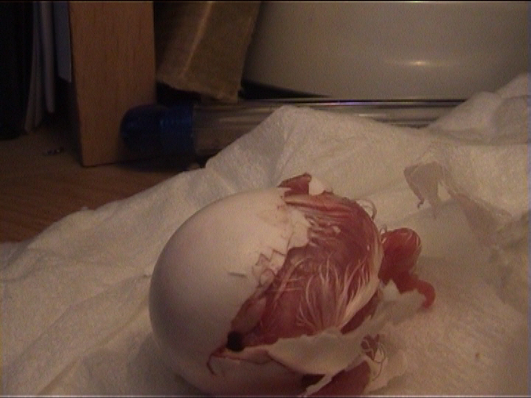 cÃ©sarienne 11.jpg