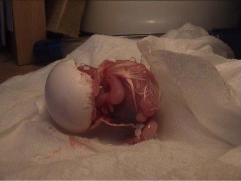 cÃ©sarienne 15.jpg