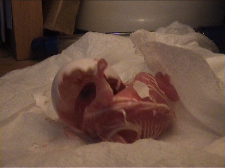 cÃ©sarienne 18.jpg