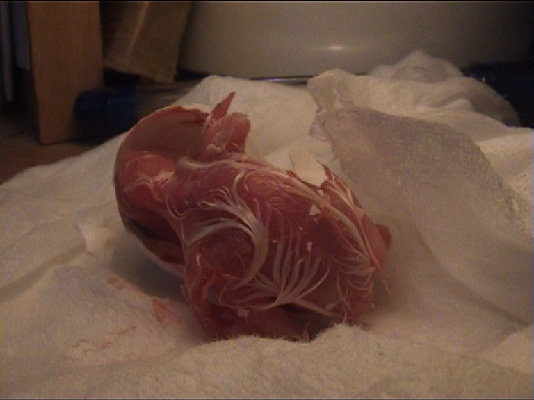 cÃ©sarienne 19.jpg