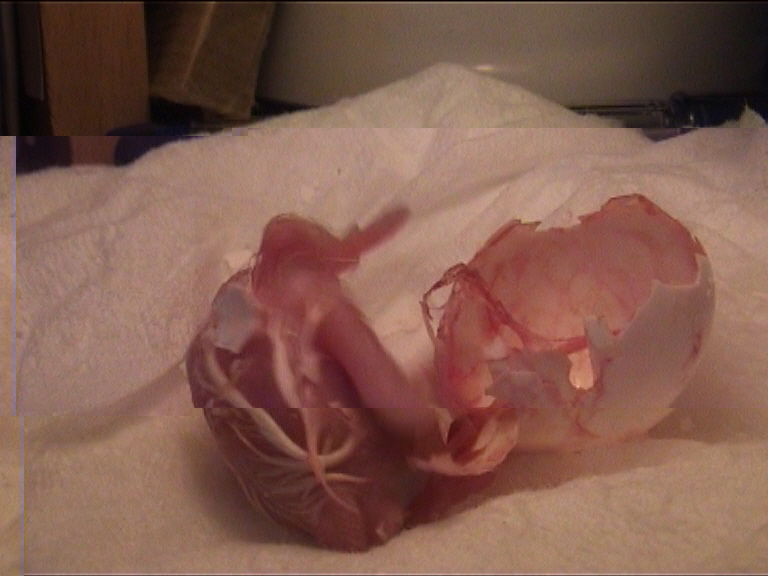 cÃ©sarienne 21.jpg