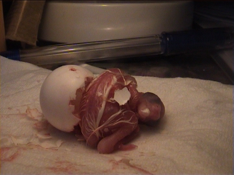 cÃ©sarienne 30.jpg