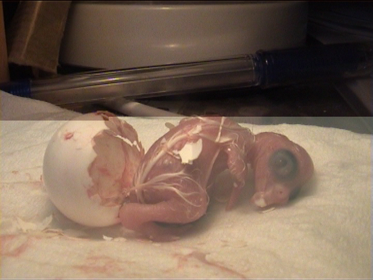 cÃ©sarienne 31.jpg